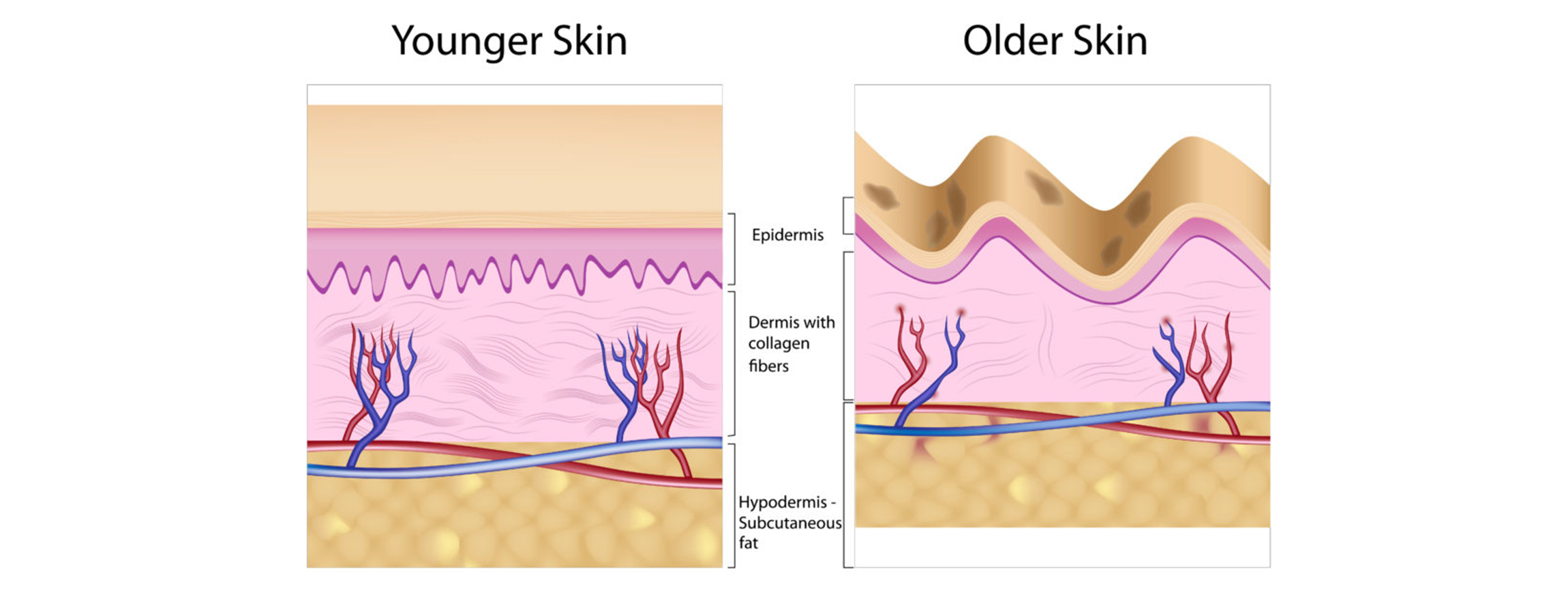 The natural signs of ageing skin